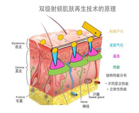 李佳齊推薦的便攜式美容儀,歐姆龍輕觸開關(guān)性價比王炸!